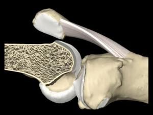 Patellofemoral Joint viewed from the side.